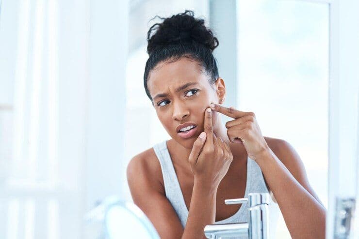a woman pops an acne on her face