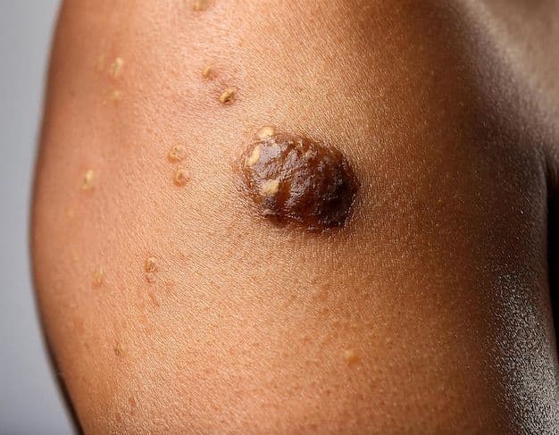 Skin cancer on the skin